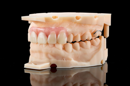 Partial Denture