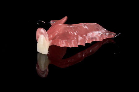Partial Denture