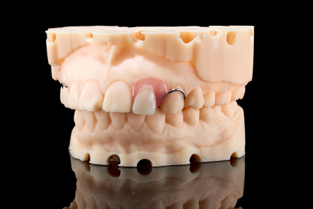 Partial Denture