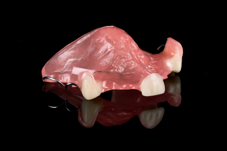 Partial Denture