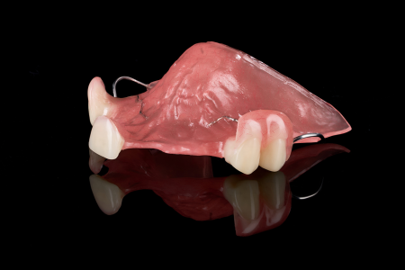 Partial Denture