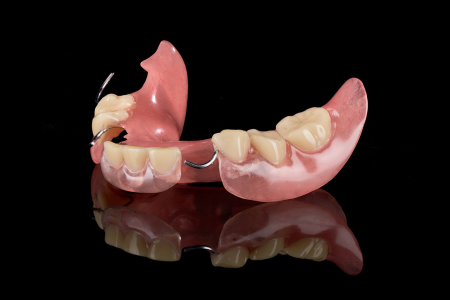 Partial Denture