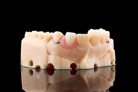 Partial Denture