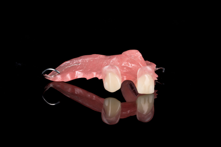 Partial Denture