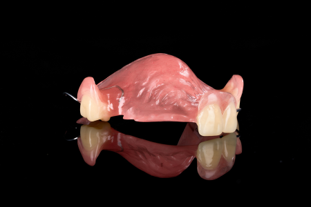 Partial Denture