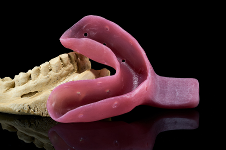 Partial Denture