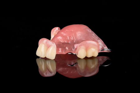 Partial Denture