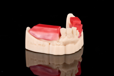 Partial Denture