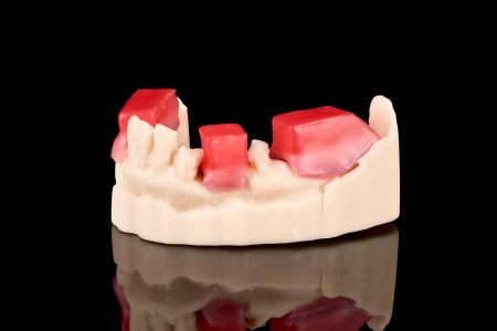 Partial Denture