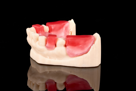 Partial Denture