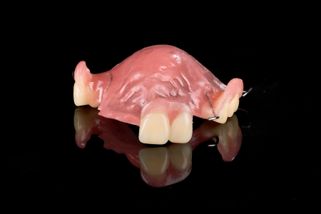 Partial Denture