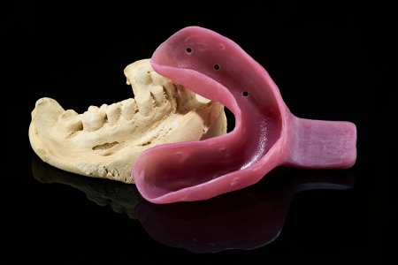 Partial Denture