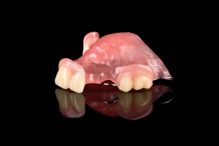Partial Denture