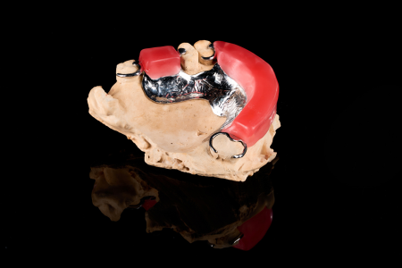 Partial Denture