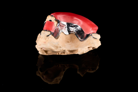 Partial Denture