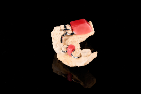 Partial Denture