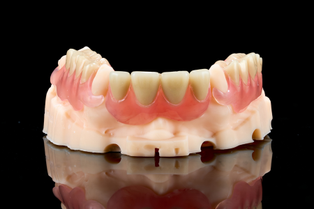 Partial Denture