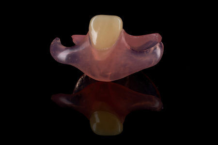 Partial Denture