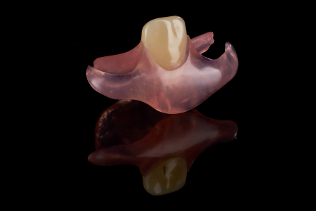 Partial Denture