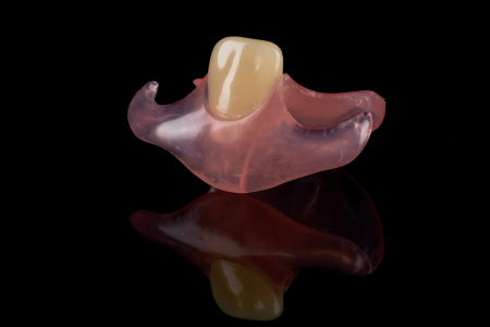 Partial Denture