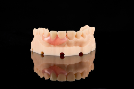 Partial Denture