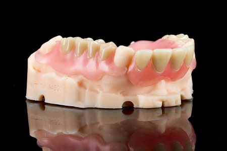 Partial Denture