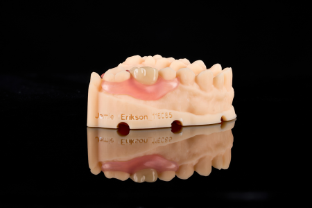 Partial Denture