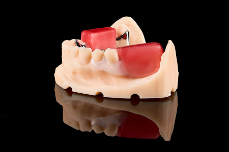 Partial Denture