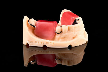 Partial Denture