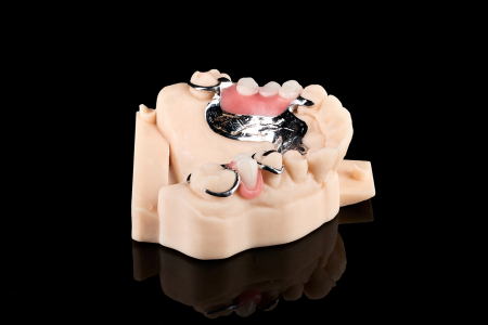 Partial Denture