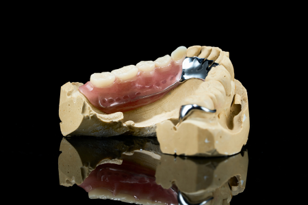 Partial Denture