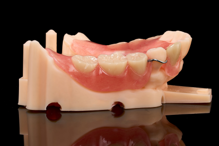 Partial Denture