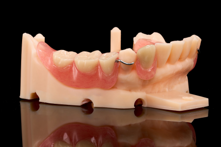 Partial Denture