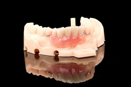 Partial Denture
