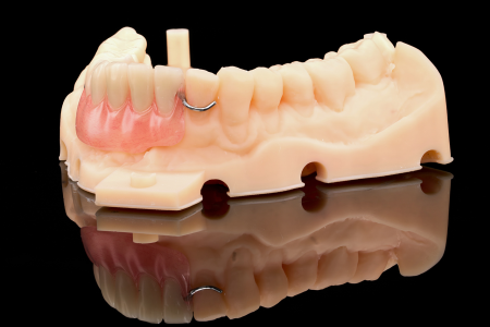 Partial Denture