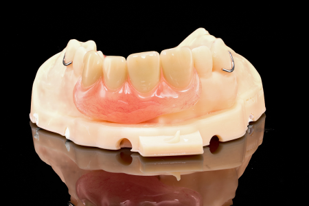 Partial Denture