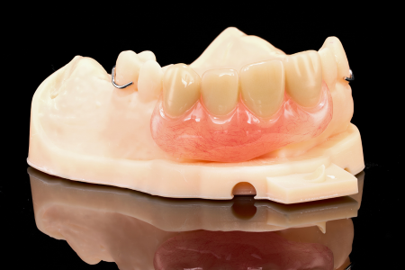 Partial Denture