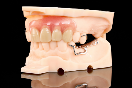 Partial Denture