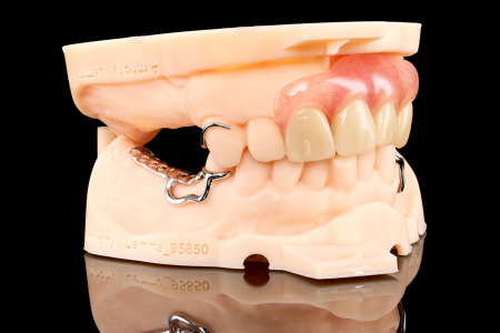 Partial Denture
