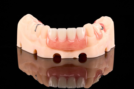 Partial Denture