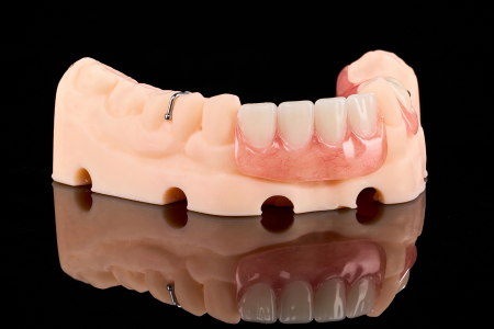 Partial Denture