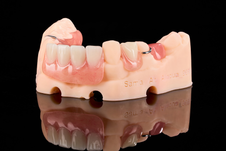 Partial Denture