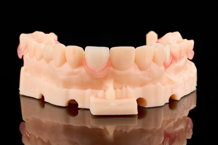 Partial Denture