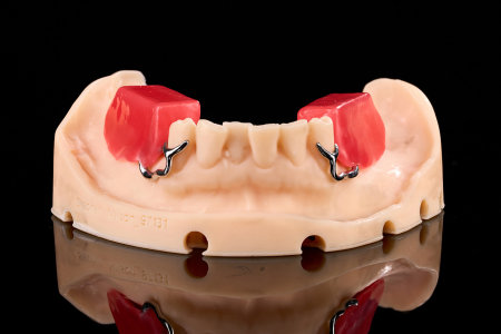 Partial Denture