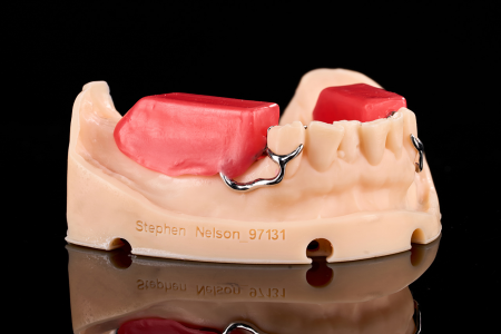 Partial Denture
