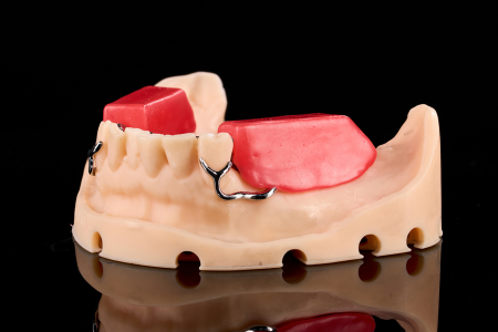 Partial Denture