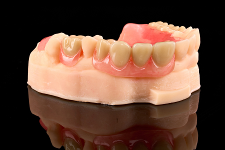 Partial Denture