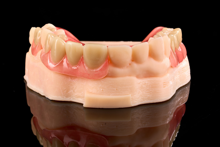 Partial Denture