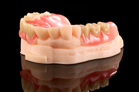 Partial Denture