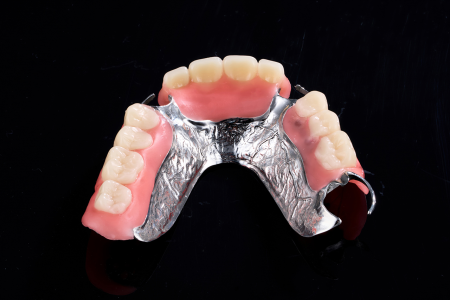Partial Denture